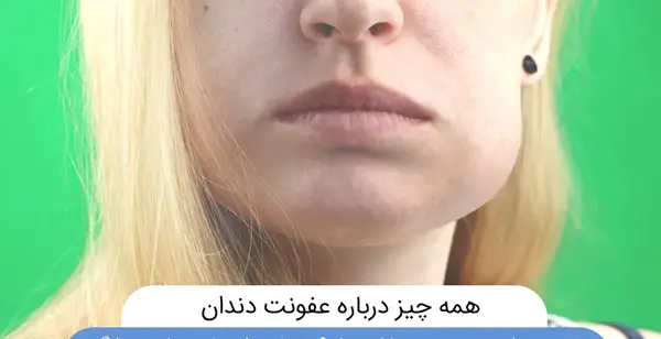 عکس عفونت داخل گلو