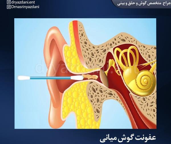 عکس از داخل گوش انسان