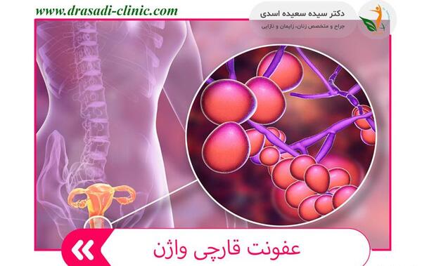 عکس عفونت قارچی داخل واژن