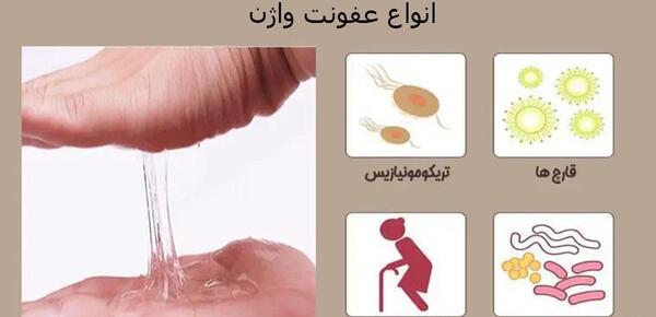 عکس عفونت قارچی داخل واژن