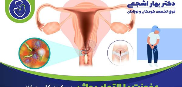 عکس عفونت قارچی داخل واژن