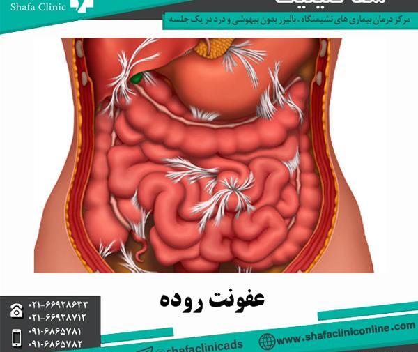 عکس کامل داخل شکم انسان