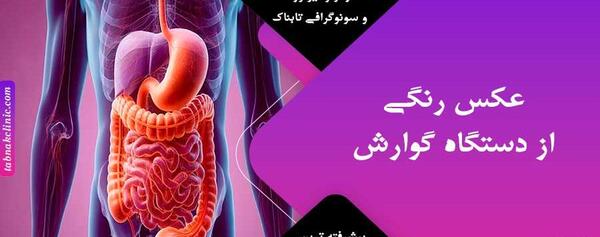 عکس اجزای داخل شکم انسان