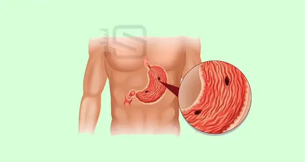 عکس اجزای داخل شکم انسان