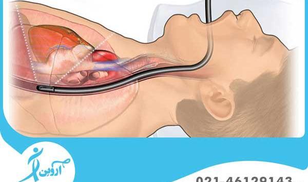 عکس اجزای داخل شکم انسان