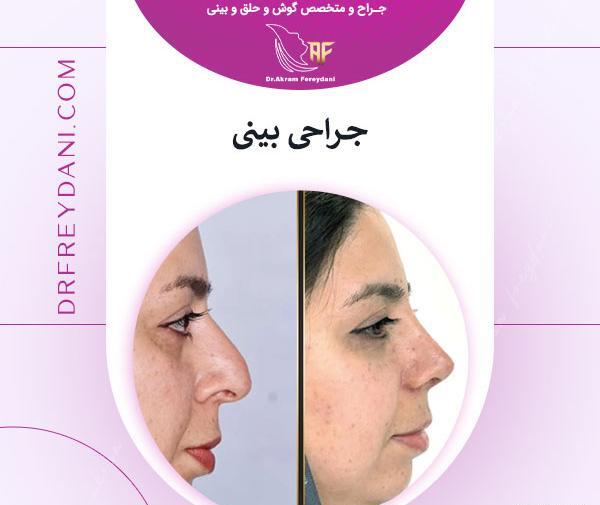 عکس های داخل دماغ