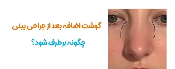 عکس های داخل دماغ