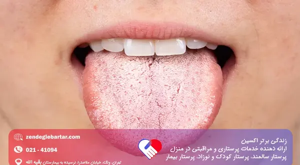 عکس داخل دهان انسان سالم