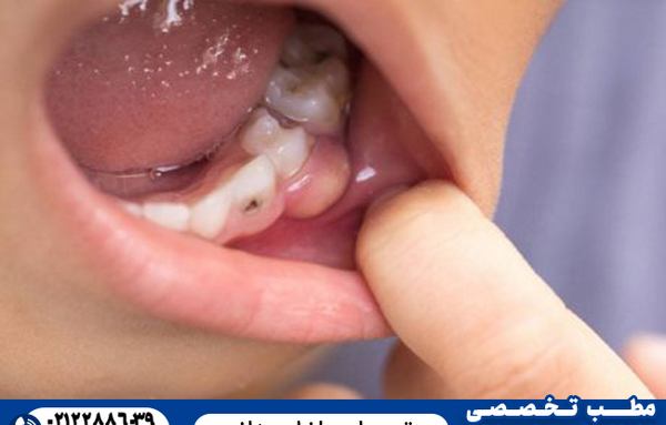 عکس داخل دهان انسان سالم