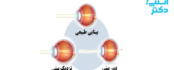 عکس از داخل چشم انسان