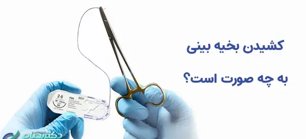 عکس بخیه داخل بینی