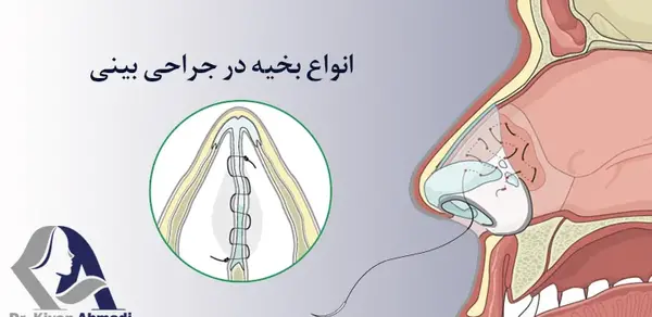 عکس بخیه داخل بینی