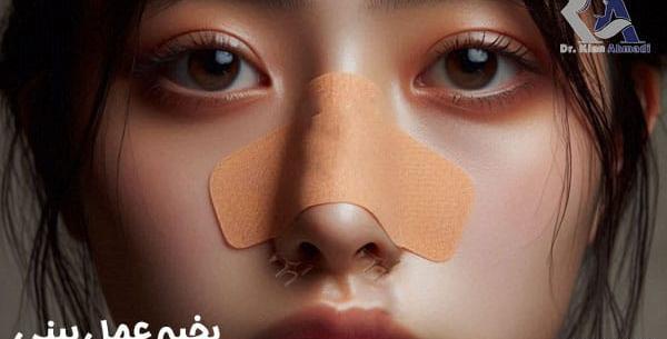 عکس بخیه داخل بینی