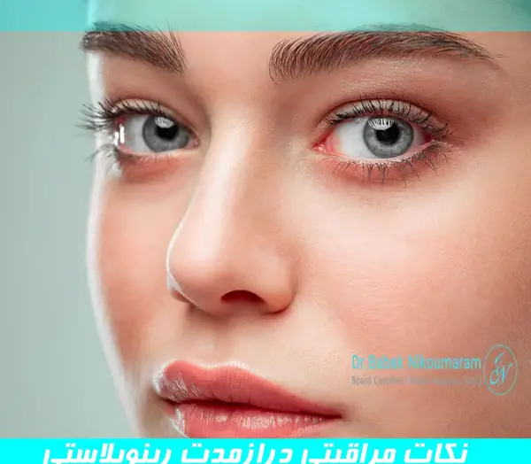 عکس بخیه داخل بینی