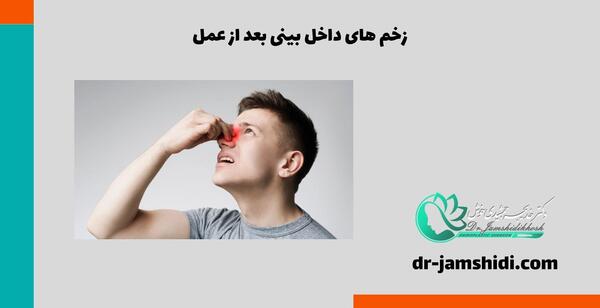 عکس بخیه داخل بینی