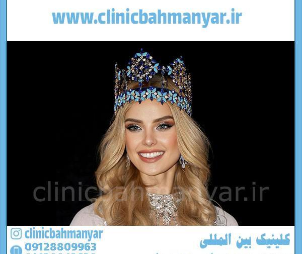 عکس های ملکه ی زیبایی جهان