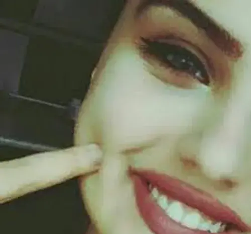 عکس پروف دخترونه چال گونه
