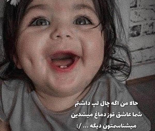 عکس پروف دخترونه چال گونه
