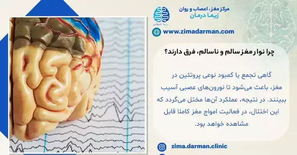 عکس ام ار ای مغز سالم و ناسالم