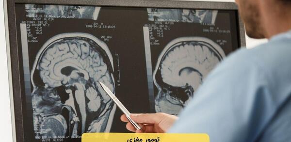 تومور عکس ام ار ای مغز سالم