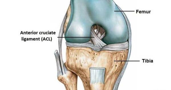 acl عکس ام ار ای پارگی رباط زانو