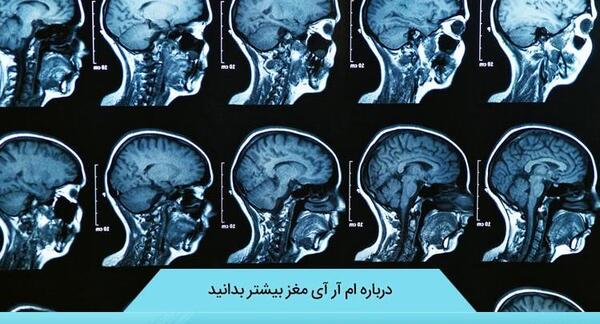 عکس ام آر آی مغز سالم