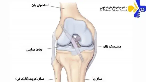 عکس ام ار ای رباط صلیبی سالم
