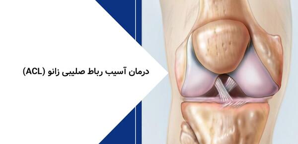 عکس ام ار ای رباط صلیبی پاره