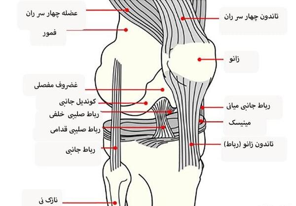 عکس ام ار ای رباط صلیبی پاره شده