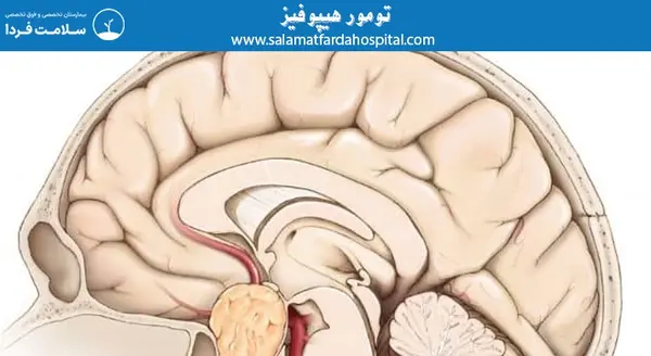 عکس ام ار ای هیپوفیز سالم