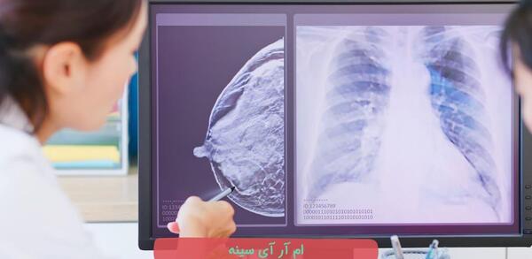 عکس ام ار ای در مشهد