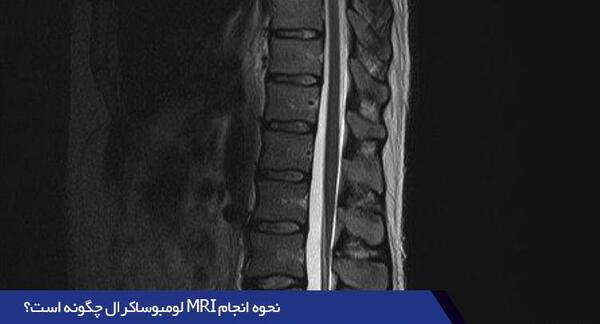 عکس ام ار ای تنگی نخاع