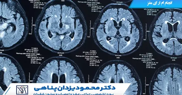 عکس نخاع سالم در ام ار ای