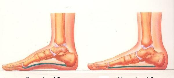 عکس ام ار ای مچ دست سالم