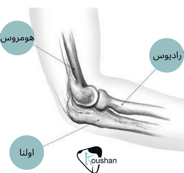 عکس ام ار ای مچ دست سالم