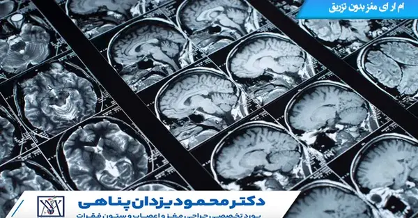 عکس ام ار ای مغز ام اس