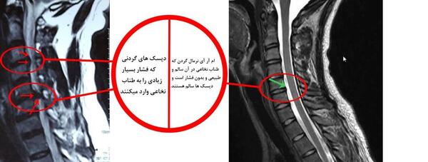 عکس ام ار ای گردن سالم