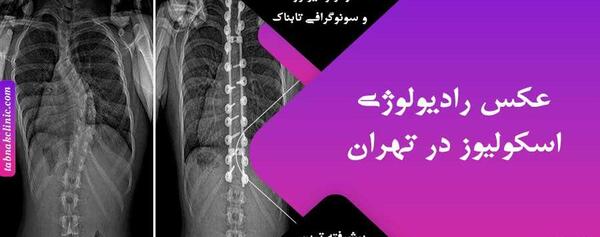 عکس ام ار ای از ستون فقرات سالم