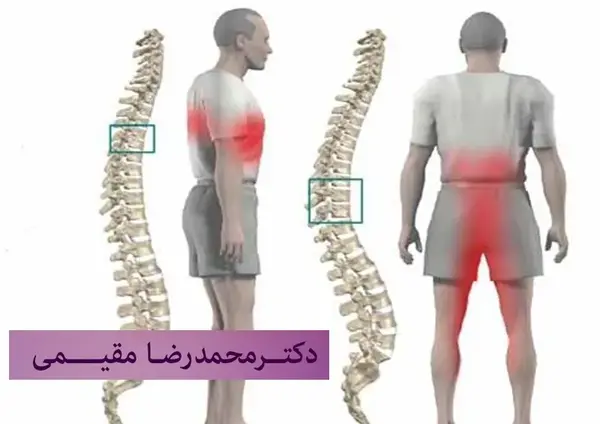 عکس ام آر آی ستون فقرات سالم