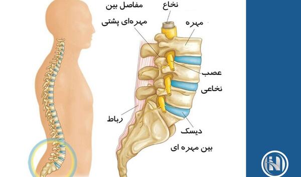 عکس ام ار ای ستون فقرات اسیب دیده