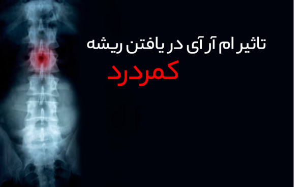 عکس ام ار ای عصب سیاتیک