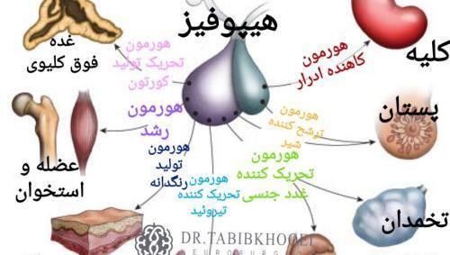 عکس غده هیپوفیز در ام ار ای