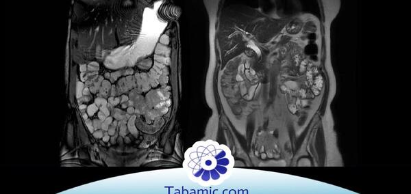 نوبت عکس ام ار ای شیراز