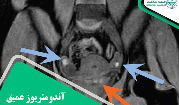 عکس ام ار ای شکم سالم