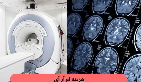 عکس ام ار ای شکم سالم