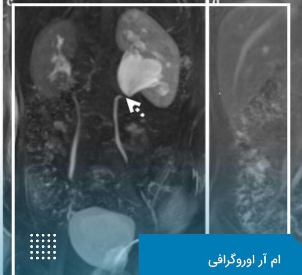 عکس ام آر آی شکم و لگن