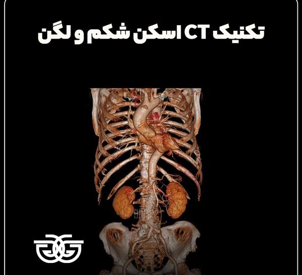 عکس ام ار ای شکم و لگن سالم