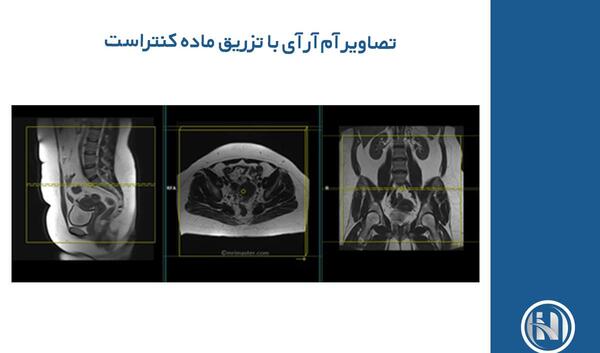 عکس دستگاه ام ار ای شکم و لگن