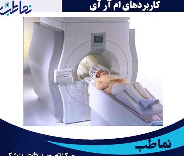 عکس دستگاه ام ار ای شکم و لگن