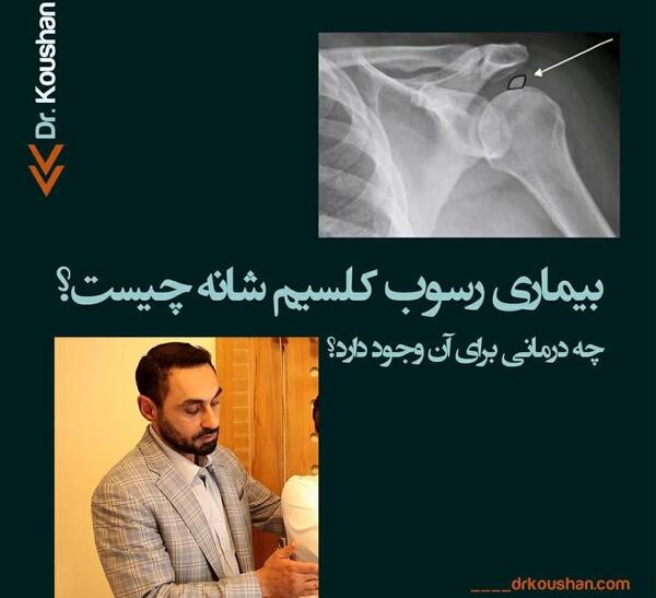 عکس ام ار ای شانه اسیب دیده